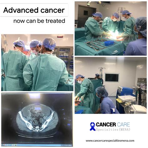 Advanced cancer now can be treated | Cancer Care Center UAE