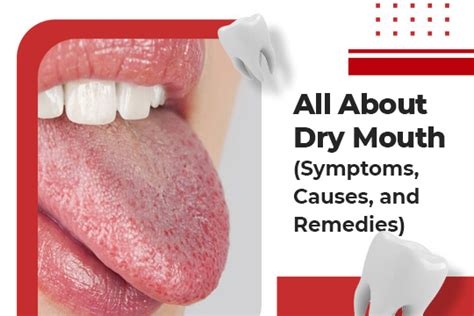 All You Need to Know About Dry Mouth | Dentistry On Dusk