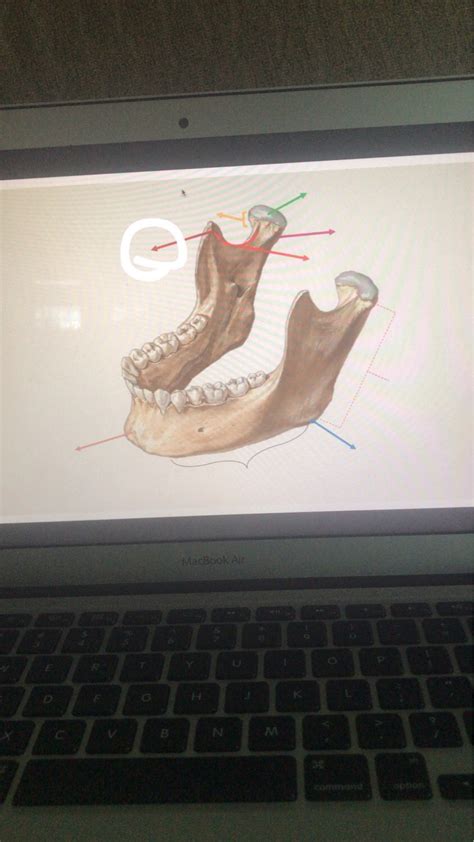 Mandibula Flashcards | Memorang