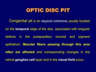 OPTIC DISC PIT Pathogenesis and Management | PPT