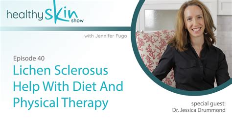 040: Lichen Sclerosus Help With Diet And Physical Therapy w/ Dr ...