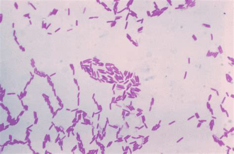 Paenibacillus polymyxa - Wikiwand