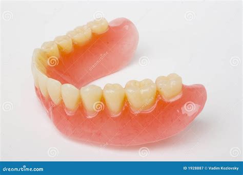 Dental prosthesis stock image. Image of denture, prosthesis - 1928887