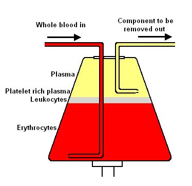 Apheresis - wikidoc