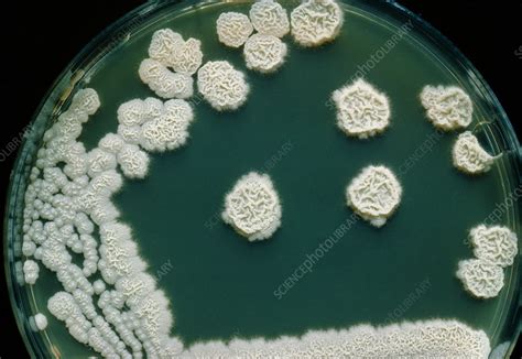 Food spoilage fungus, Candida krusei - Stock Image - B250/0195 ...