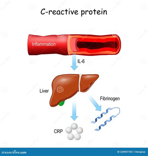 C-reactive Protein (CRP, Human) Inflammation Biomarker Protein ...