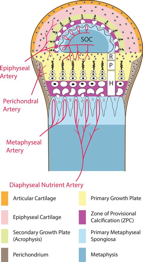 Imaging of Pediatric Growth Plate Disturbances | RadioGraphics