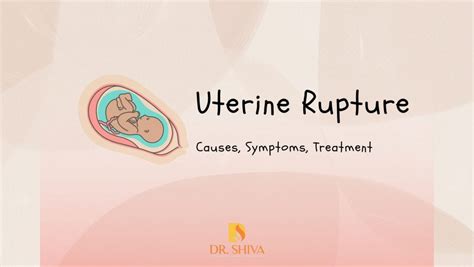 Uterine Rupture | Childbirth complications | Treatment