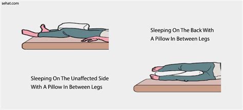 Sleeping Positions After Anterior Hip Replacement [And Instructions]