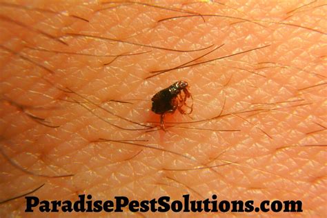 Can Fleas Live On Humans?