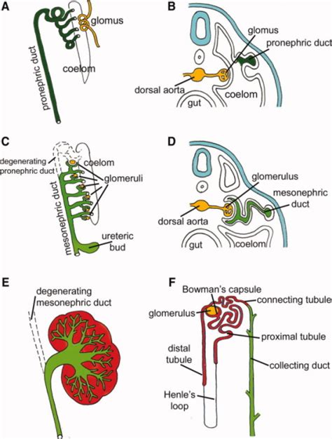 Series of schematic diagrams depicting the morphologica | Open-i