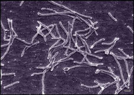 Methanobacterium - Warren Kelley's Weebly