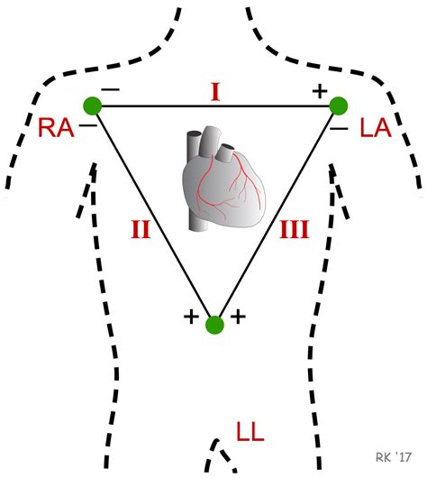 CV Physiology | Electrocardiogram Standard Limb Leads (Bipolar)