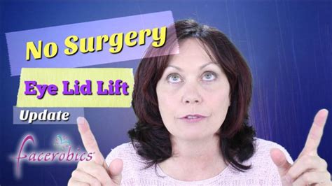 #NoSurgery Eye Lid Lift Update - EAWM Series 1 | FACEROBICS #faceexercises | Droopy eyes, Face ...