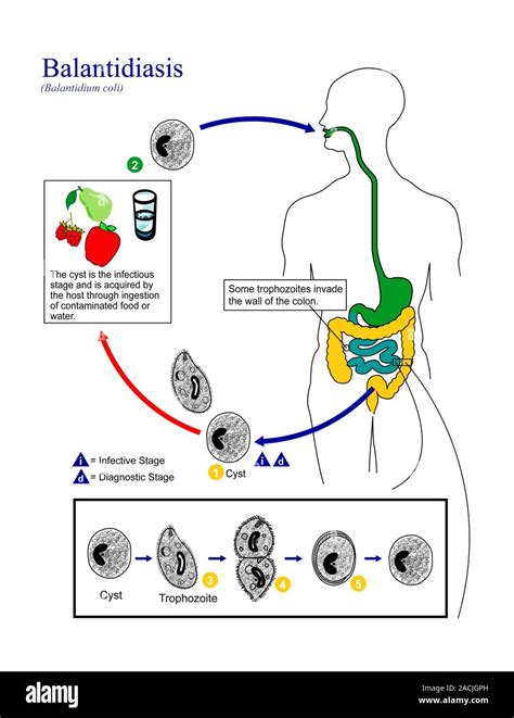 Balantidiasis life cycle. Diagram showing the life cycle of the parasitic protozoan Balantidium ...