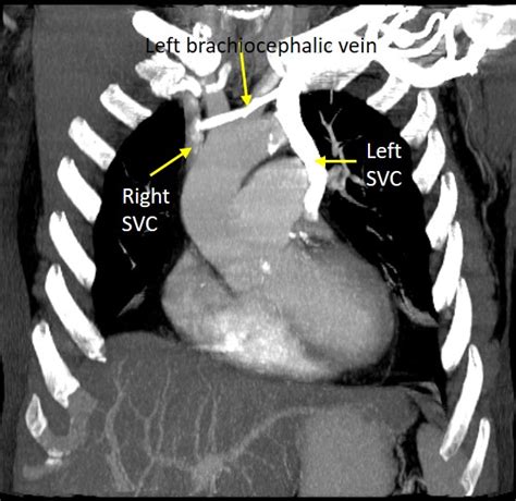 Radiology Cases – Page 40 – Compilation of cases; emphasize on imaging findings.