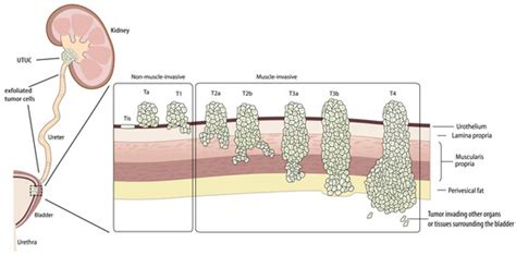 Diagnostics | Free Full-Text | Clinical Characteristics and Current Status of Treatment for ...