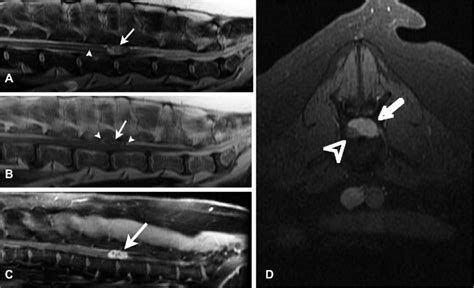 MRI of the lumbar vertebral column including sagittal T2-weighted (A),... | Download Scientific ...