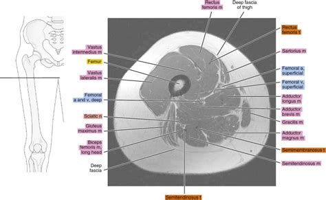 MRI of the thigh | Radiology Key