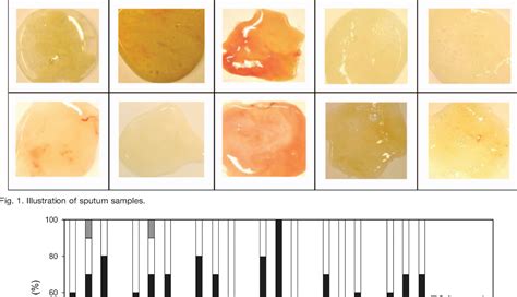 [PDF] Reproducibility of the Sputum Color Evaluation Depends on the ...