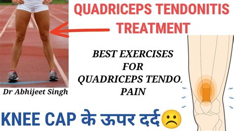 Quadriceps Tendonitis Exercises | Quadriceps Tendon Pain Relief ...