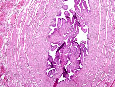 Oviduct Histology - Oviduct - histology slide