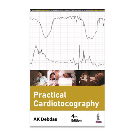 Buy Practical Cardiotocography | Medtree.co.in