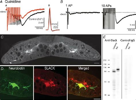 The effect of quinidine on the non-K Ca -sAHP, and immunohistochemical... | Download Scientific ...