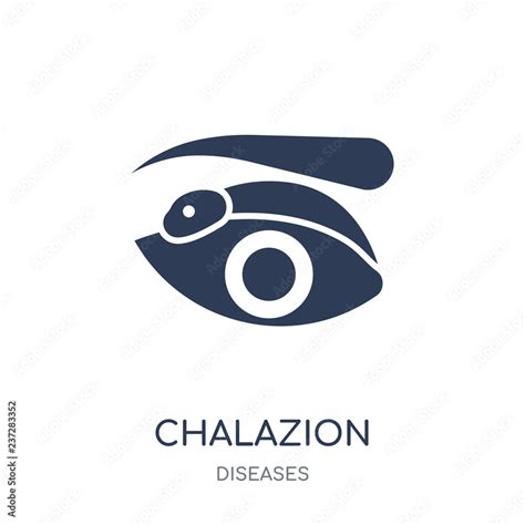 Chalazion icon. Chalazion filled symbol design from Diseases collection. Stock Vector | Adobe Stock