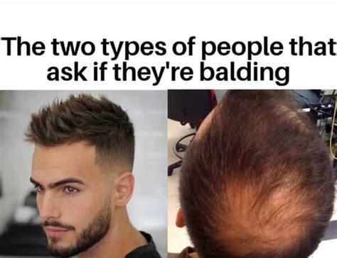 25 Bald Memes for All the People That Are Follicularly Challenged