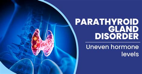 Parathyroid gland disorders- Causes, Symptoms, Diagnosis and Treatment