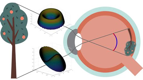 Understanding Ocular Wavefront aberrations - Myopia Profile