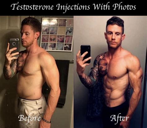 Testosterone Injections Before And After Photos | HGH