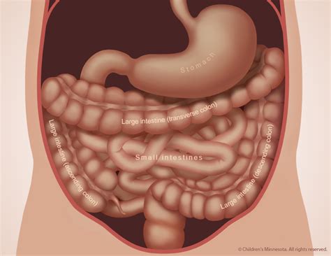 Intestinal Atresia in Babies | Children's Minnesota