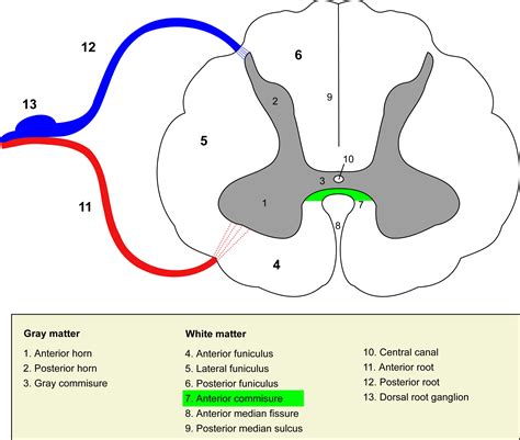 Anterior white commissure - wikidoc