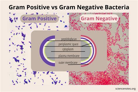 Gram Positive Vs Gram Negative Bacteria Recently Updated ! - TrendRadars