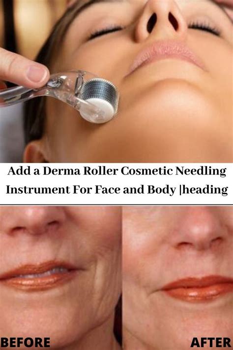 Derma Roller Cosmetic Needling Instrument For Face and Body | MRS 540 Titanium Micro Needle in ...