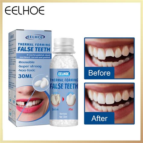 Eelhoe (30g )Dental Restoration Temporary Tooth repair kit glue denture teeth and gaps ...