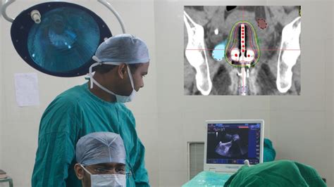 Cervical Brachytherapy Procedure