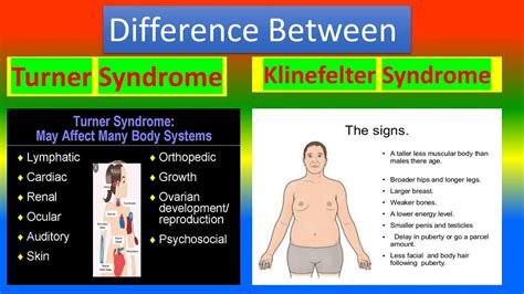 Difference between Turner Syndrome and Klinefelter Syndrome - YouTube