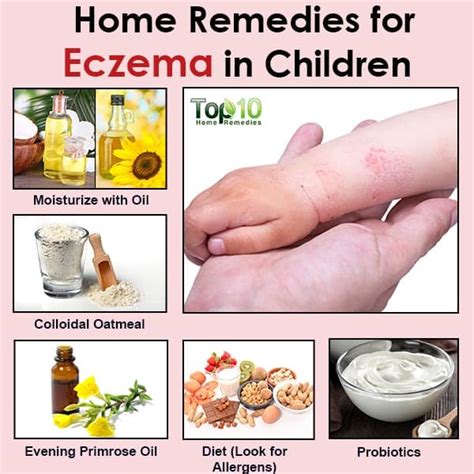 Neonatal Eczema