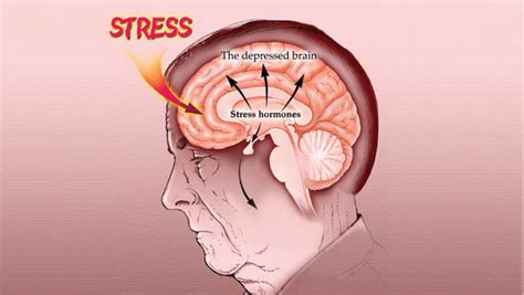 Entomophobia: Symptoms, Causes and Treatments