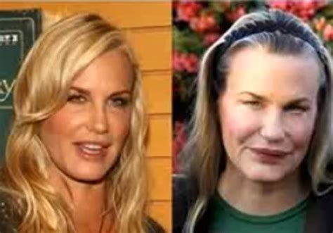 17 Celebrity Before-And-After Plastic Surgery Disasters - Business Insider