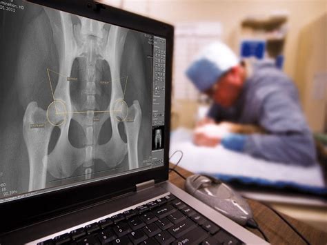 Computed Radiography Digital X-Ray Repair Help: Learn How to Fix It Yourself.