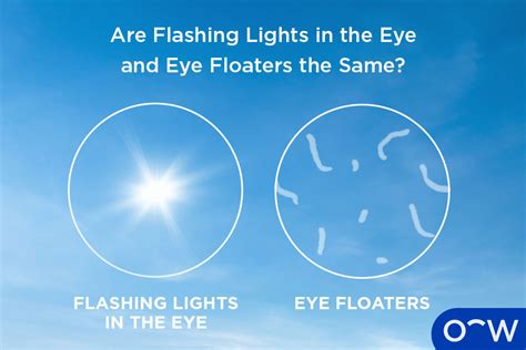 Seeing Flashing Lights in the Corner of Eye: What is it, Causes, and ...