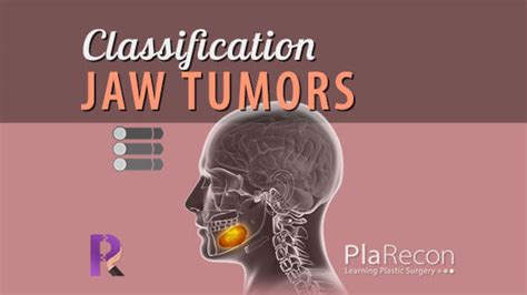 Jaw Tumors Classification [Mnemonic]