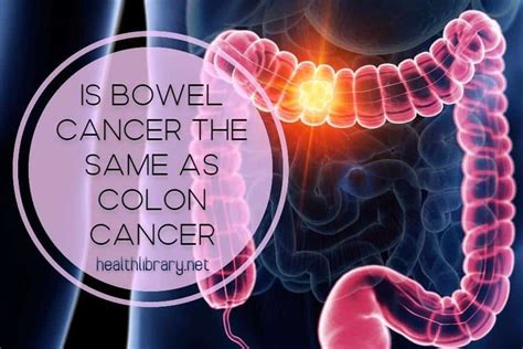 Colon Versus Bowel Cancer: What Is the Difference? · HealthLibrary.net