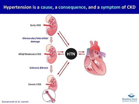 3-2. Hypertension in CKD. Francesco Emma (eng)