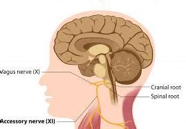 Vagus Nerve Stimulation for Tinnitus : Natural Treatment for Tinnitus