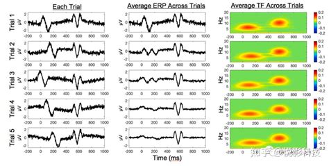 时频分析方法及其在EEG脑电中的应用 - 知乎
